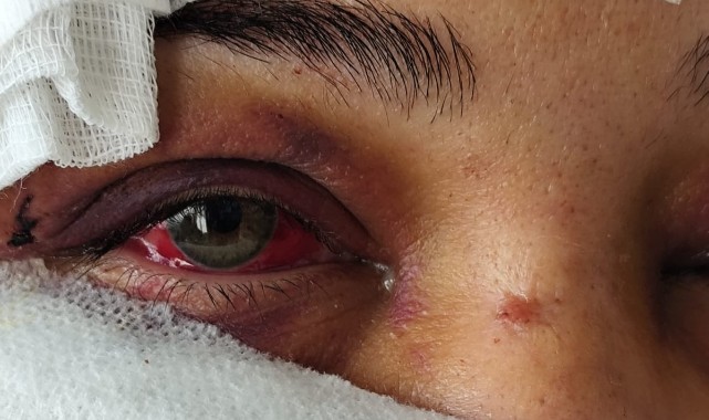 Şanlıurfa’da 2 Yılda 12 Kadın Katledildi