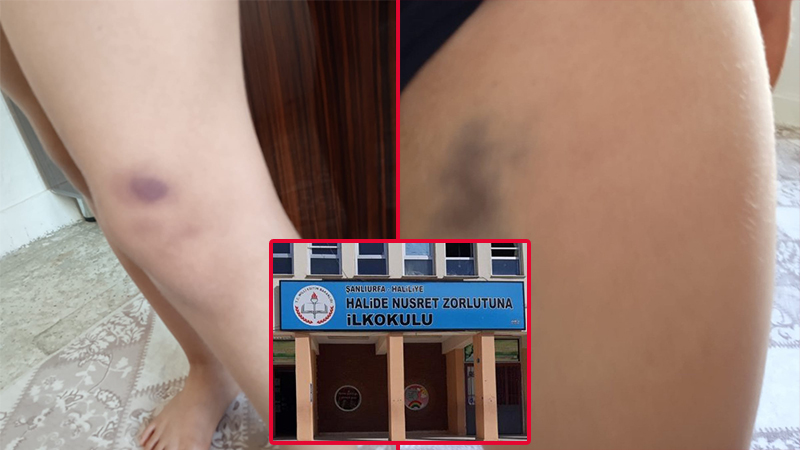 Urfa’da ilkokulda oğlu darp edilen anne şikayetçi oldu