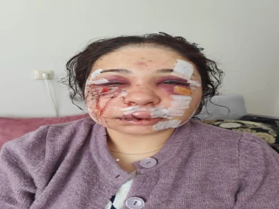 Cumhurbaşkanlığı korumasından eşe şiddet iddiası:“Güzelliğini elinden alacağım, yarım kalan işi tamamlayacağım”