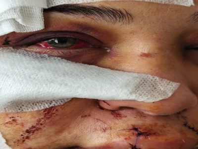 Fatma Çakmak’a işkence eden Cumhurbaşkanlığı koruma polisi tutuklandı