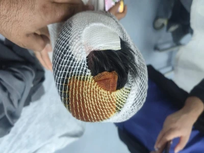 Şanlıurfa'da yaralı kartal tedaviye alındı